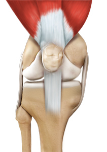 Ligament Reconstruction