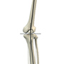 Knee Angular Deformities (Knock Knees and Bow Legs)