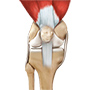 Ligament Reconstruction